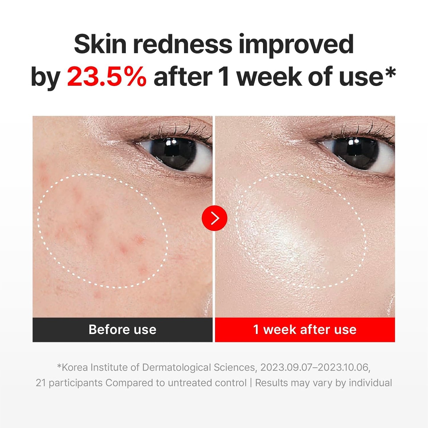 CENTELLIAN 24 MADECA CREAM TIME REVERSE (SEASON7, 50ml/1.69fl oz) | Intensive Skin Repair & Firming