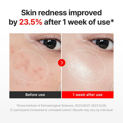 CENTELLIAN 24 MADECA CREAM TIME REVERSE (SEASON7, 50ml/1.69fl oz) | Intensive Skin Repair & Firming
